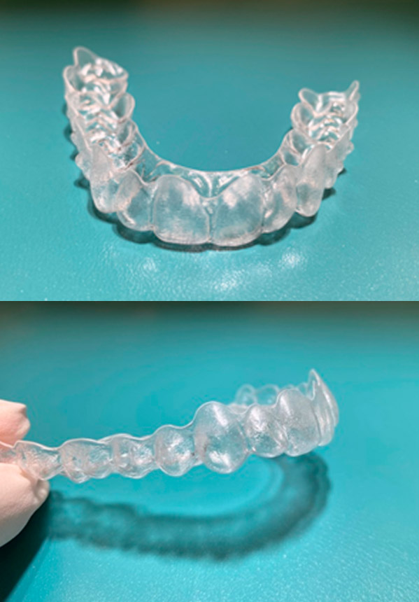 Odontología-Ortodonciainvisible-ClinicaMontesPamplona