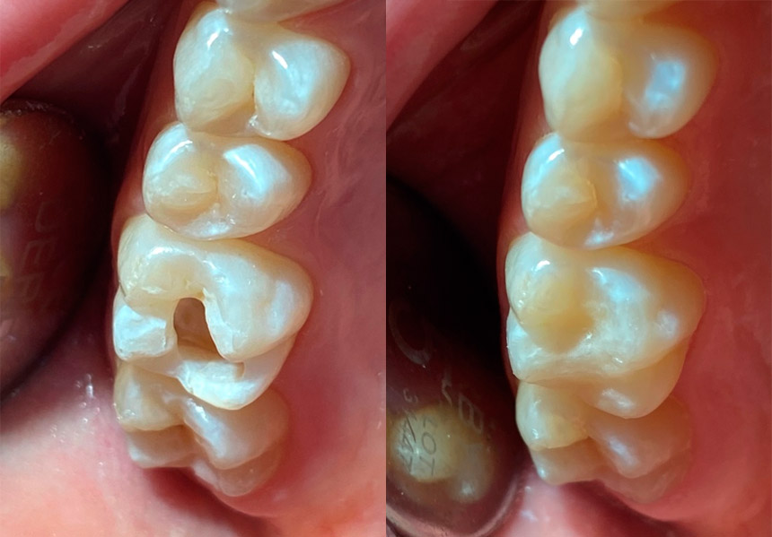Clinica Dental Montes - Odontologia Conservadora