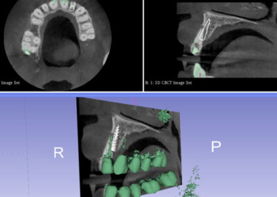 Clinica Dental Montes - Implantología oral avanzada