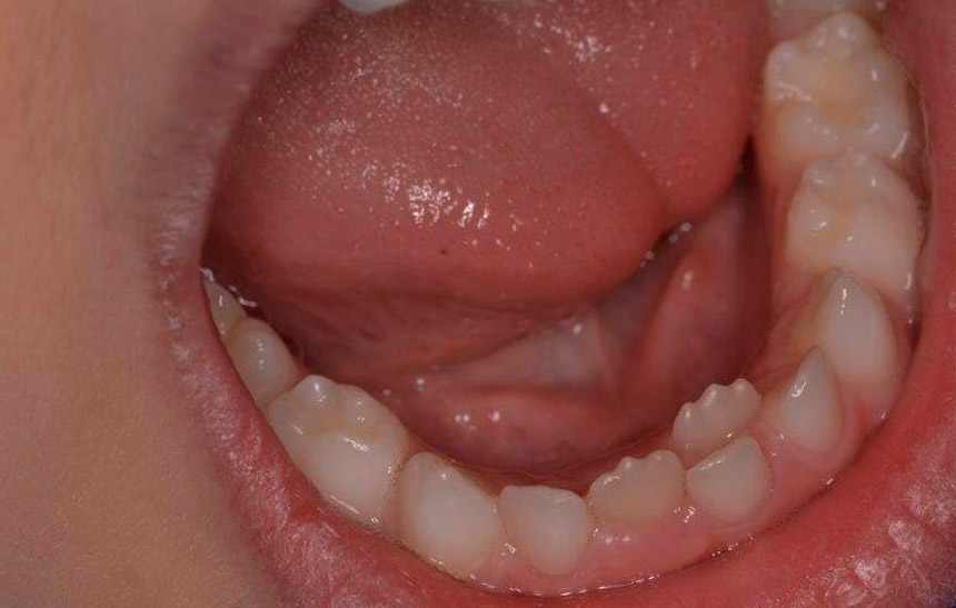 clinicadentalmontes - odontopediatria